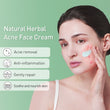 JoyPretty Herbal Day Cream For Acne Skin Care Face Moisturizer Oil Control Pimple Acne Scar Removal Cream Treatment For Women